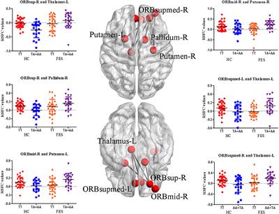 Genetic Contribution of Synapse-Associated Protein 97 to Orbitofrontal–Striatal–Thalamic Circuitry Connectivity Changes in First-Episode Schizophrenia